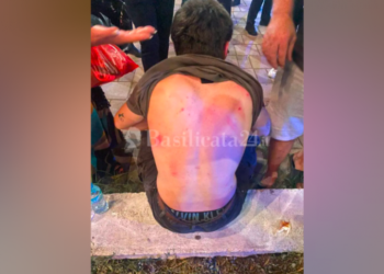 “Pushimet u kthyen në makth”, dhunohen 6 turistë italianë në Tiranë