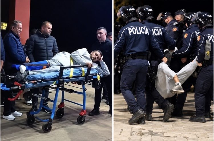 PROTESTA/ Dalin pamjet e rënda/ Momenti kur Ledion Ballës i thyhet këmba!