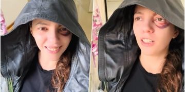 U plagos gjatë protestës, aktivistja Eva Pango del nga spitali me një thirrje për protestuesit