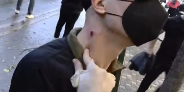 Doktoresha Silvana Shametaj Ruli, letër ministres së Shëndetësisë: Mjeku nuk mund të jetë kurrë zgjatim i forcës policore!